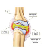 Articulations - Douleurs - Muscles