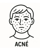 ACNE