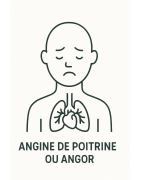 ANGINE DE POITRINE OU ANGOR