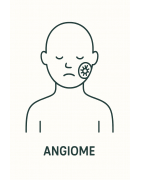 ANGIOME