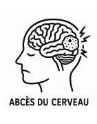 ABCES DU CERVEAU
