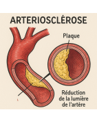 ARTERIOSCLEROSE/ATHEROSCLEROSE