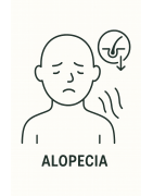 ALOPECIE